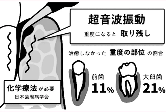 従来の治療法